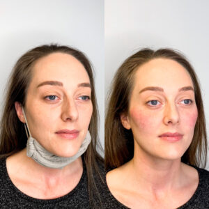 A woman with a neck brace on and another person wearing it.