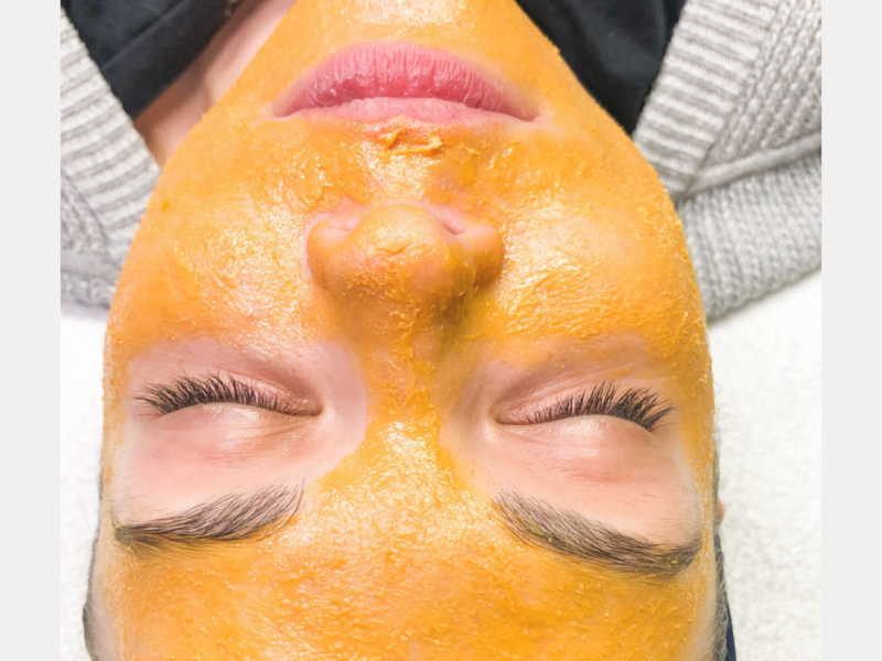 A woman with orange peel on her face.
