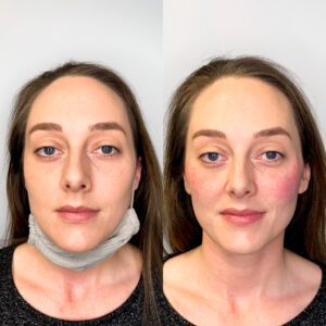 A woman with a neck brace on and another person wearing it.