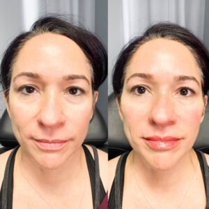 A woman before and after using the makeup.