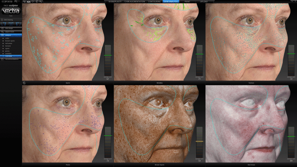 A series of photos showing the face and eyes of an older woman.