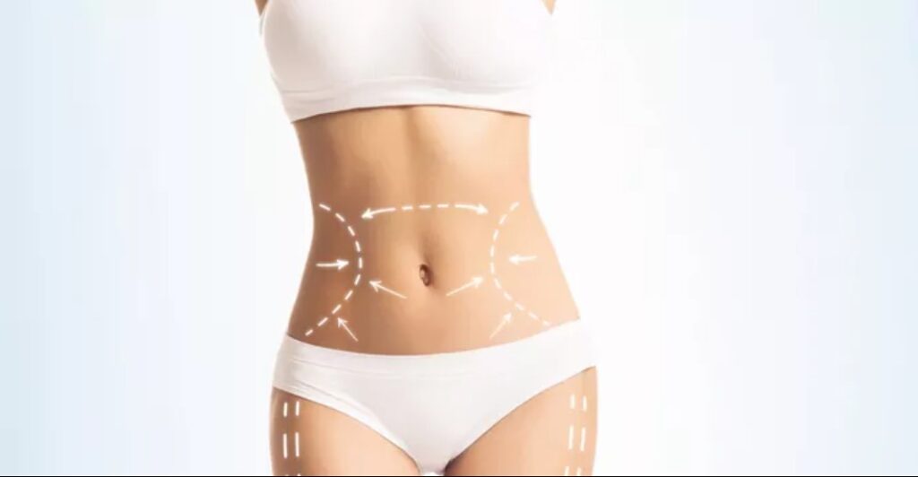 A woman in white underwear with lines drawn on her stomach.