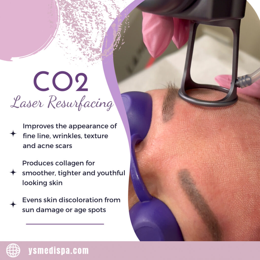 A person getting their face painted with co 2 laser resurfacing.