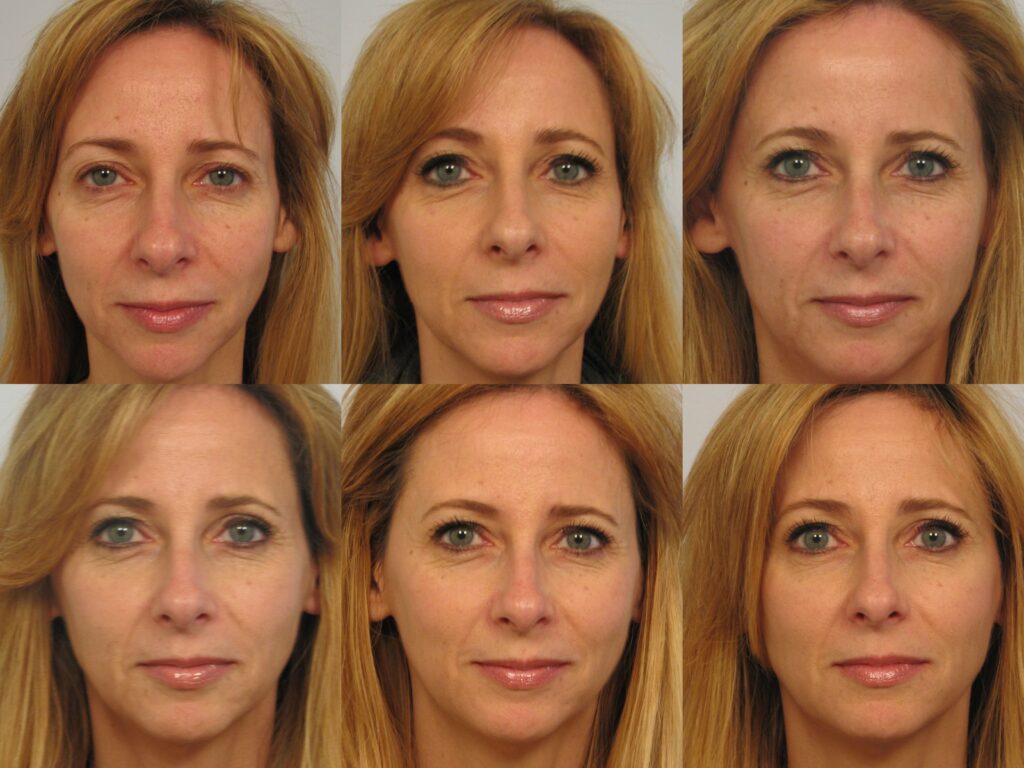 A woman 's face is shown in six different frames.