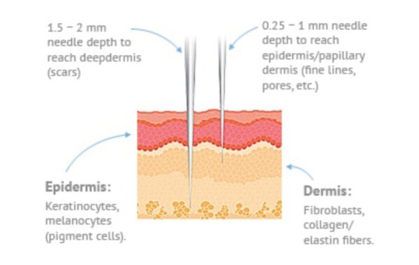 A diagram of the different layers in skin.