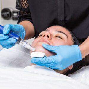 A woman getting her face waxed by an esthetician.