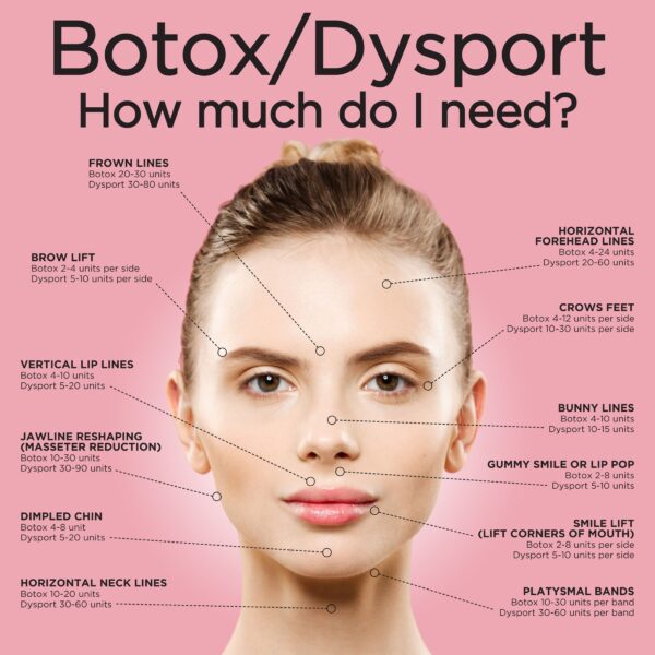 A woman 's face with lines drawn to show where botox and dysport are located.